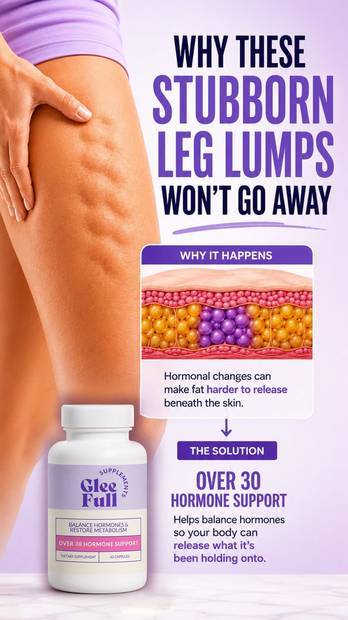 Leg Lumps